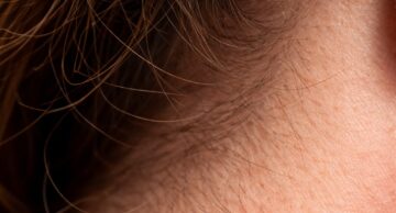 Kleszcze już aktywne!