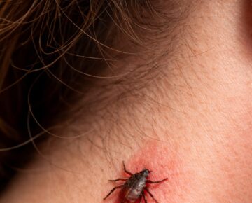 Kleszcze już aktywne!